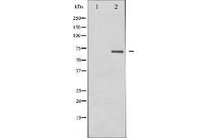 Western blot analysis of PKCB expression in HeLa whole cell lysates,The lane on the left is treated with the antigen-specific peptide. (PKC beta anticorps  (C-Term))