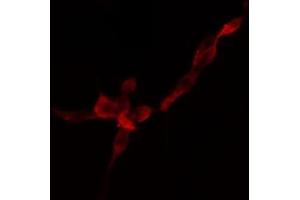 ABIN6274757 staining HuvEc cells by IF/ICC. (RPS4Y1 anticorps)