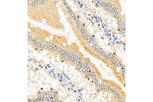 Immunohistochemistry analysis of paraffin embedded rat small intestine using PMCA1 (ABIN7073155) at dilution of 1: 1000
