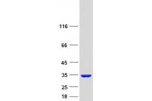 Validation with Western Blot