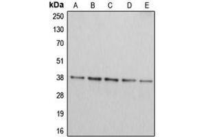 Western blot analysis of Arginase 2 expression in Jurkat (A), HepG2 (B), HEK293T (C), A549 (D), PC12 (E) whole cell lysates. (ARG2 anticorps  (C-Term))