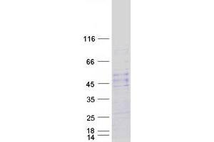 Validation with Western Blot