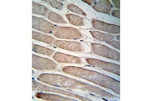 Formalin-fixed and paraffin-embedded human skeletal muscle reacted with PDK4 Antibody (C-term) (ABIN391039 and ABIN2841206) , which was peroxidase-conjugated to the secondary antibody, followed by DAB staining. (PDK4 anticorps  (C-Term))