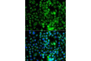 Immunofluorescence analysis of A549 cell using EPHA1 antibody. (EPHA1 anticorps)
