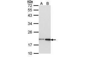 Image no. 1 for anti-Non-Metastatic Cells 1, Protein (NM23A) Expressed in (NME1) (AA 1-120) antibody (ABIN467572) (NME1 anticorps  (AA 1-120))