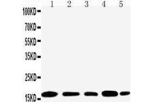 Anti-TIA1 antibody, Western blotting Lane 1: JURKAT Cell Lysate Lane 2: RAJI Cell Lysate Lane 3: CEM Cell Lysate Lane 4:  Cell Lysate Lane 5: K562 Cell Lysate (TIA1 anticorps  (N-Term))