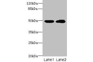 Western blot All lanes: HNRNPH1 antibody at 8 μg/mL Lane 1: HepG2 whole cell lysate Lane 2: MCF-7 whole cell lysate Secondary Goat polyclonal to rabbit IgG at 1/10000 dilution Predicted band size: 50 kDa Observed band size: 50 kDa