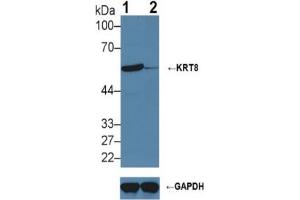 Rabbit Detection antibody from the kit in WB with Positive Control:  Sample Knockout Varification: Lane 1: Wild-type Hela cell lysate; Lane 2: KRT8 knockout Hela cell lysate;. (KRT8 Kit ELISA)