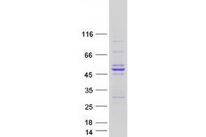 Validation with Western Blot