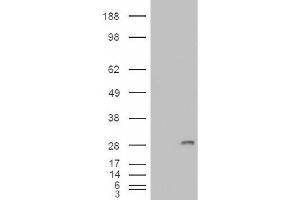 Image no. 2 for anti-Insulin-Like Growth Factor Binding Protein 6 (IGFBP6) (Internal Region) antibody (ABIN374965) (IGFBP6 anticorps  (Internal Region))