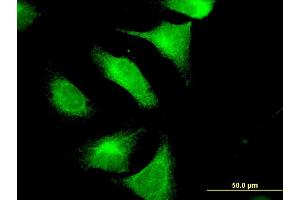 Immunofluorescence of monoclonal antibody to CNTN4 on HeLa cell. (Contactin 4 anticorps  (AA 800-898))