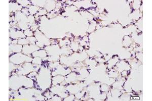 Formalin-fixed and paraffin embedded rat lung labeled with Anti PABP Polyclonal Antibody, Unconjugated (ABIN704786) at 1:200 followed by conjugation to the secondary antibody and DAB staining (PABP anticorps  (AA 101-200))
