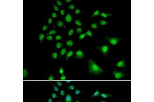 Immunofluorescence analysis of U2OS cells using UBE3C Polyclonal Antibody (UBE3C anticorps)