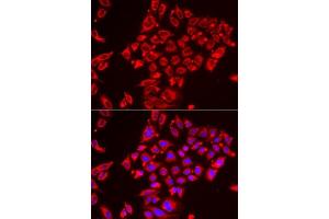 Immunofluorescence analysis of HeLa cells using ST3GAL3 antibody. (ST3GAL3 anticorps  (AA 30-375))