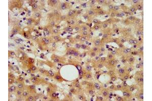 IHC image of ABIN7145458 diluted at 1:800 and staining in paraffin-embedded human liver tissue performed on a Leica BondTM system. (CHN2 anticorps  (AA 1-91))