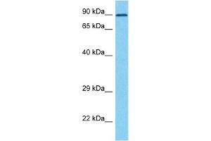 Host:  Rabbit  Target Name:  ZP2  Sample Type:  HT1080 Whole Cell lysates  Antibody Dilution:  1. (ZP2 anticorps  (C-Term))