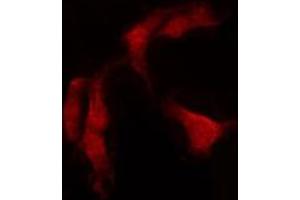 ABIN6274171 staining HepG2 by IF/ICC. (PRKCSH anticorps  (Internal Region))