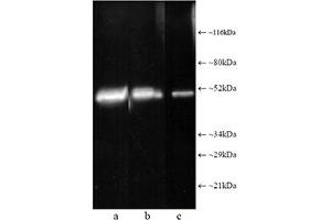 Western blot analysis: Composite luminograph of (a) HeLa S3 cytosolic preparation, (b) purified 26S proteasome, and (c) human placental proteasome fraction after SDS PAGE followed by blotting onto PVDF membrane and probing with antibody . (Proteasome 19S Rpt1/S7 Subunit anticorps)