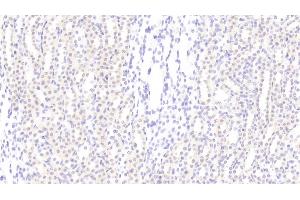Detection of CCND1 in Rat Kidney Tissue using Polyclonal Antibody to Cyclin D1 (CCND1)