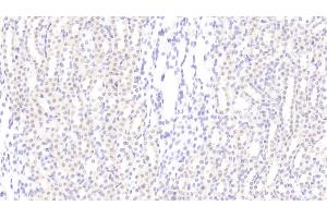 Detection of CCND1 in Rat Kidney Tissue using Polyclonal Antibody to Cyclin D1 (CCND1) (Cyclin D1 anticorps  (AA 1-295))