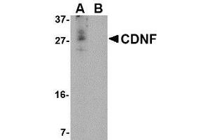 Western blot analysis of CDNF in A-20 cell lysate in (A) the absence and (B) the presence of blocking peptide with AP30222PU-N CDNF antibody at 1 μg/ml. (CDNF anticorps  (N-Term))