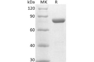 Western Blotting (WB) image for Poliovirus Receptor-Related 4 (PVRL4) (Active) protein (Fc Tag) (ABIN7320868)
