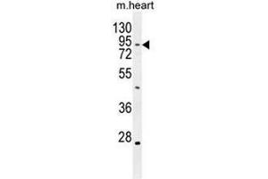 TBC14 Antibody (Center) western blot analysis in mouse heart tissue lysates (35µg/lane). (TBC1D14 anticorps  (Middle Region))