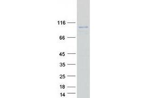 Validation with Western Blot