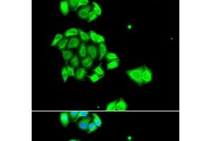 Immunofluorescence analysis of A549 cells using Rad51D Polyclonal Antibody (RAD51D anticorps)