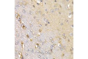 Immunohistochemistry of paraffin-embedded rat brain using SFRP2 antibody (ABIN6131355, ABIN6147675, ABIN6147677 and ABIN6221030) at dilution of 1:200 (40x lens).