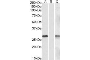 Lane A - ABIN570830 (1µg/ml) staining of HEK293 overexpressing Human DYDC1 lysate (10µg protein in RIPA buffer) Lane B - ABIN570830 (1µg/ml) staining of HEK293 mock-transfected lysate (10µg protein in RIPA buffer). (DYDC1 anticorps  (Internal Region))