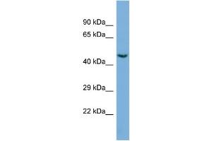 Western Blotting (WB) image for anti-Cyclin-Dependent Kinase 19 (CDK19) (C-Term) antibody (ABIN2786077) (CDK19 anticorps  (C-Term))