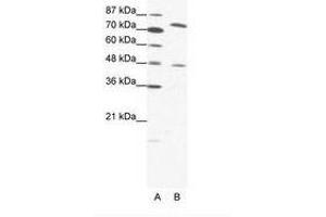 Image no. 1 for anti-Zinc Finger Protein 225 (ZNF225) (AA 127-176) antibody (ABIN202877) (ZNF225 anticorps  (AA 127-176))