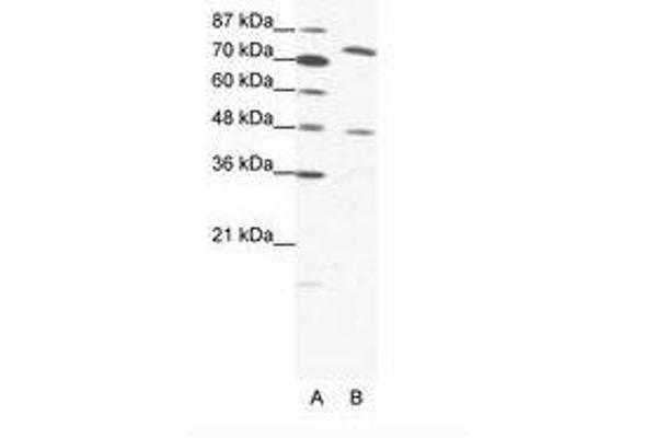 ZNF225 抗体  (AA 127-176)