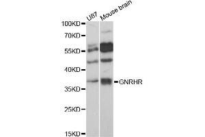 Western blot analysis of extracts of various cell lines, using GNRHR antibody (ABIN6292108) at 1:3000 dilution. (GNRHR anticorps)