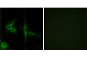Immunofluorescence analysis of LOVO cells, using ELTD1 Antibody.