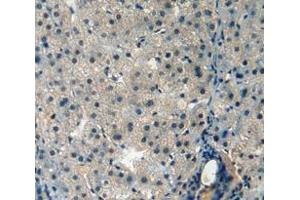 Used in DAB staining on fromalin fixed paraffin- embedded liver tissue (AMBP anticorps  (AA 22-203))