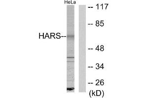 Western Blotting (WB) image for anti-Histidyl-tRNA Synthetase (HARS1) (C-Term) antibody (ABIN1849156) (HARS1/Jo-1 anticorps  (C-Term))