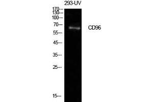 Western Blot (WB) analysis of 293-UV cells using CD96 Polyclonal Antibody. (CD96 anticorps  (Internal Region))