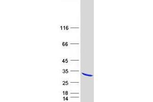 Validation with Western Blot (RAB10 Protein (Myc-DYKDDDDK Tag))