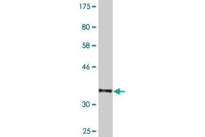 Western Blot detection against Immunogen (36. (NXF3 anticorps  (AA 1-100))