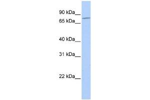 WB Suggested Anti-MZF1 Antibody Titration: 0. (MZF1 anticorps  (N-Term))