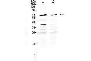 Western blot analysis of MAK using anti-MAK antibody . (MAK anticorps  (C-Term))