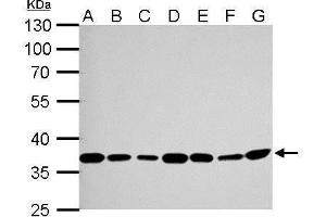 WB Image Thymidylate synthetase antibody detects TYMS protein by Western blot analysis.