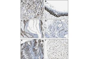 Immunohistochemical staining of endogenous human IL-33 in different human tissues (paraffin sections) using MAb to IL-33 (Nessy-1) . (IL-33 anticorps  (AA 112-270))