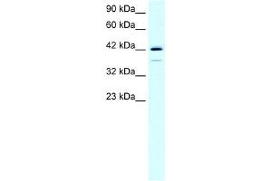 WB Suggested Anti-LHX1 Antibody Titration:  0. (LHX1 anticorps  (C-Term))