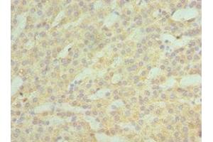 Immunohistochemistry of paraffin-embedded human kidney tissue using ABIN7142987 at dilution of 1:100