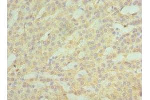 Immunohistochemistry of paraffin-embedded human kidney tissue using ABIN7142987 at dilution of 1:100 (ASAH1 anticorps  (AA 146-395))