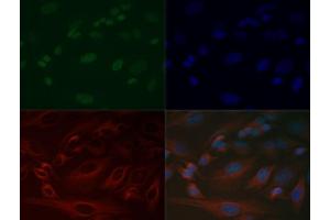 Immunofluorescence of Anti-Histone H3 K37 me1: Histone H3 monomethyl Lys37 antibody was tested at 1:200 in HeLa cells with FITC (green).