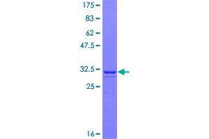 Image no. 1 for Melanoma Antigen Family A, 1 (Directs Expression of Antigen MZ2-E) (MAGEA1) (AA 98-171) protein (GST tag) (ABIN1310027)